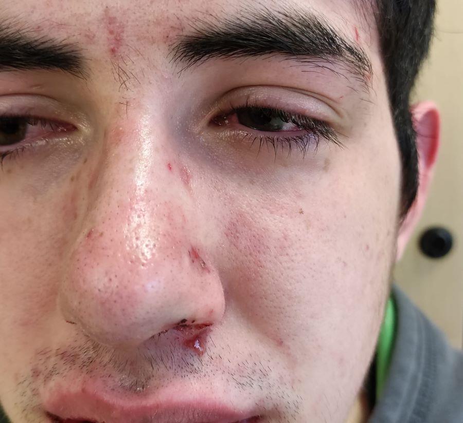 Parte del rostro de Juanjo en el que se aprecian algunas de las lesiones tras la agresión que sufrió